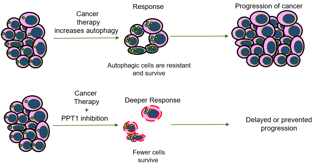 PPT1 inhibitors in combination therapy for cancer